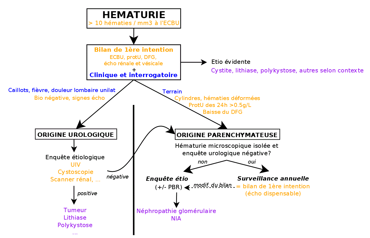 prostatite et hematurie