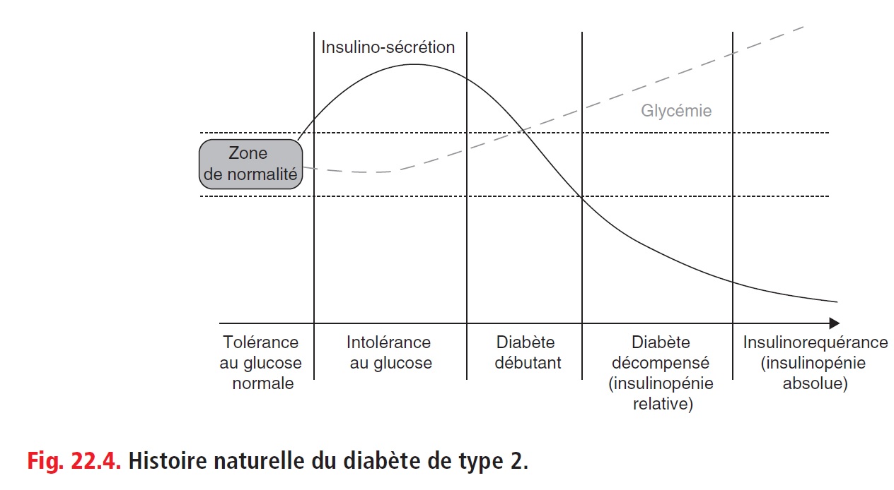 Diabète sucré de type 2 - MedG