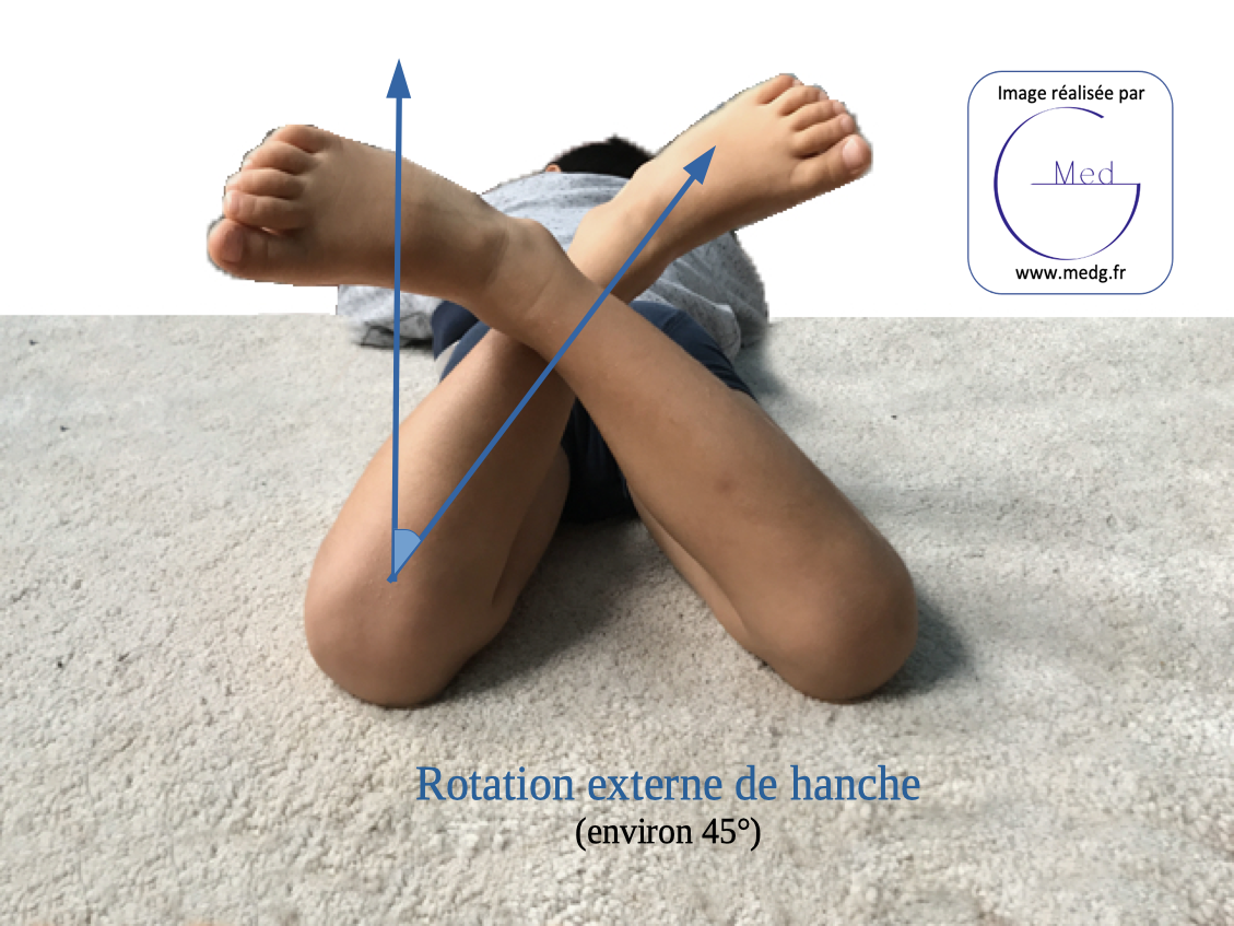 Examen orthopédique de l‘enfant MedG